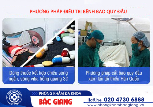 Chỉ điểm các bệnh lý bao quy đầu thường gặp, chia sẻ hướng điều trị khoa học