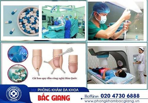 rát dương vật