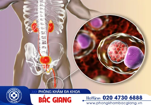 Các bệnh nam khoa thường gặp ở nam giới, những dấu hiệu liên quan