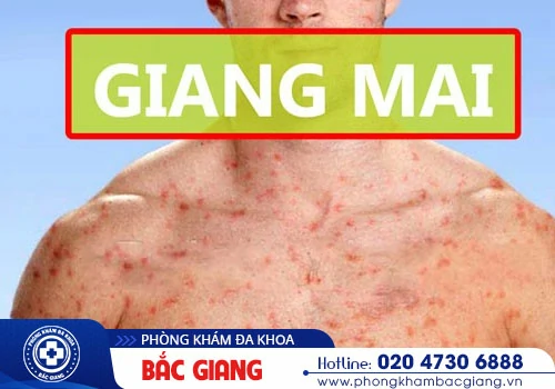 Bạn có đang mắc các bệnh sinh dục nam? Kiểm tra dấu hiệu ngay tại đây