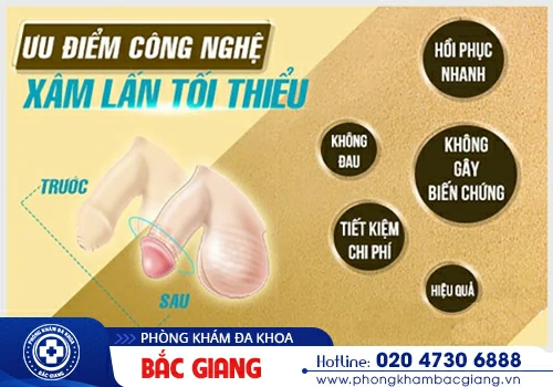 Biểu hiện dài bao quy đầu - Những nguy hiểm tiềm ẩn của căn bệnh này