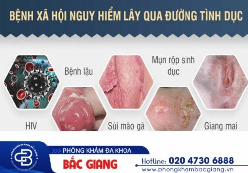 tổng hợp hình ảnh bệnh vùng kín nam 