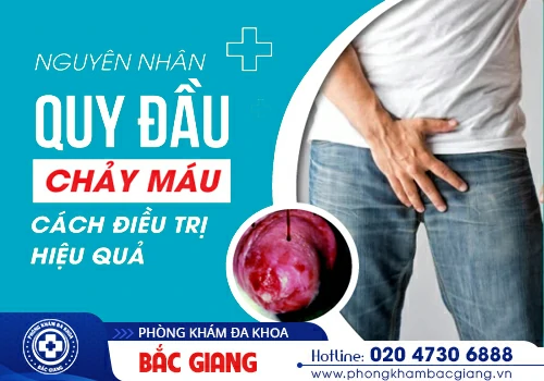 Chảy máu bao quy đầu nguyên nhân do đâu? Cách khắc phục?