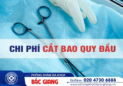 Chi phí cắt bao quy đầu bao nhiêu tiền? Những thông tin cần lưu ý