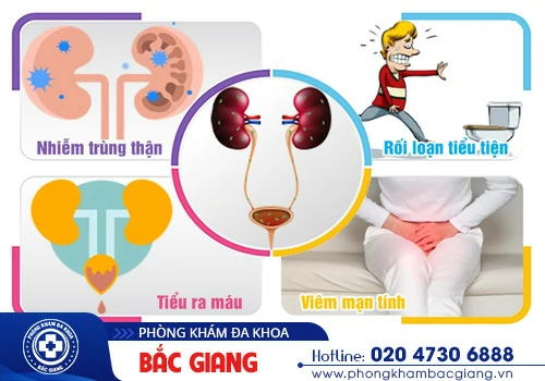 Giải pháp chữa viêm bàng quang hiệu quả bạn nên biết