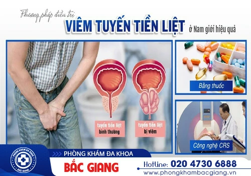 Giải pháp chữa viêm tuyến tiền liệt, ngăn ngừa kịp thời biến chứng