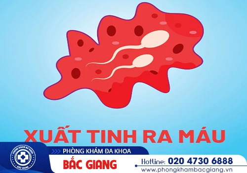 Chữa xuất tinh ra máu thế nào hiệu quả?