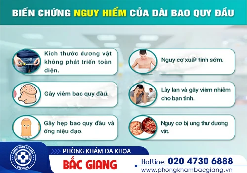 Dài bao quy đầu có sao không? Lý do mắc phải