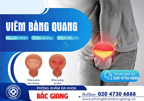 Đau bàng quang - Dấu hiệu cảnh báo sức khoẻ có vấn đề