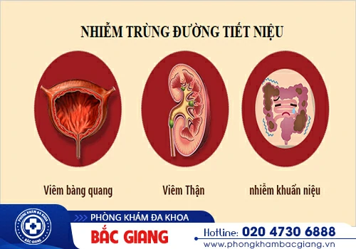 Đau bàng quang - Dấu hiệu cảnh báo sức khoẻ có vấn đề