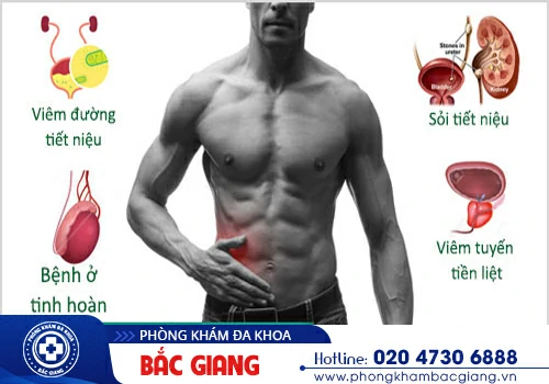 Đau bụng dưới - Dấu hiệu nguy hiểm nam giới chớ chủ quan