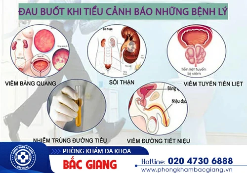 Đứng ngồi không yên vì tình trạng đau buốt khi tiểu