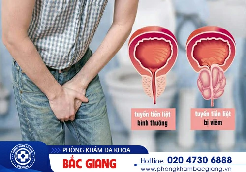 Đau dương vật là dấu hiệu của bệnh gì? Những ảnh hưởng đối với sức khoẻ