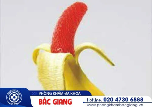 Dấu hiệu, Nguyên nhân và Cách chữa viêm bao quy đầu