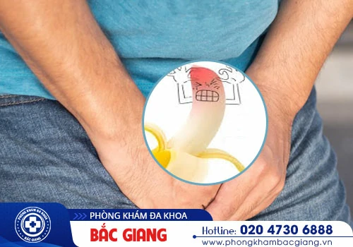Viêm quy đầu: triệu chứng và phương pháp điều trị hiệu quả