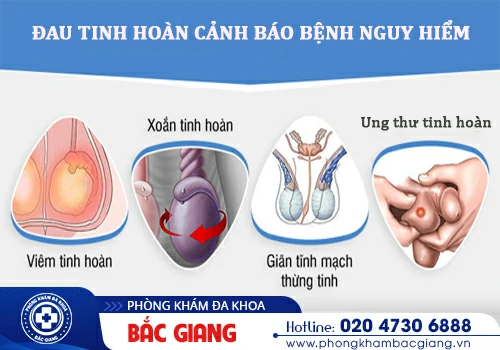Đau tinh hoàn cảnh báo những bệnh nguy hiểm không nên xem thường?