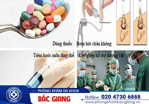 Điều trị rối loạn cương dương làm sao để đạt hiệu quả?