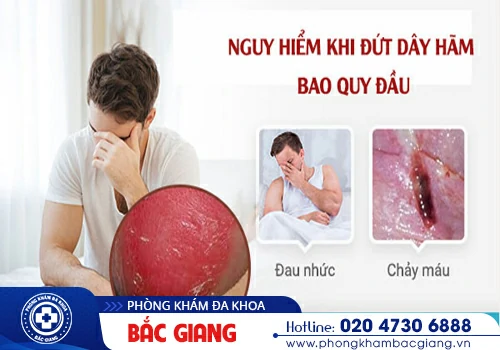 Đứt dây hãm bqđ nguyên nhân do đâu? Có nguy hiểm không?