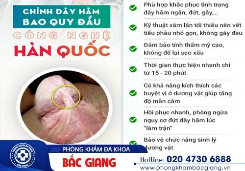 Đứt dây hãm bao quy đầu nguyên nhân do đâu? Có nguy hiểm không?