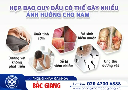 Bị hẹp bao quy đầu có nguy hiểm không?