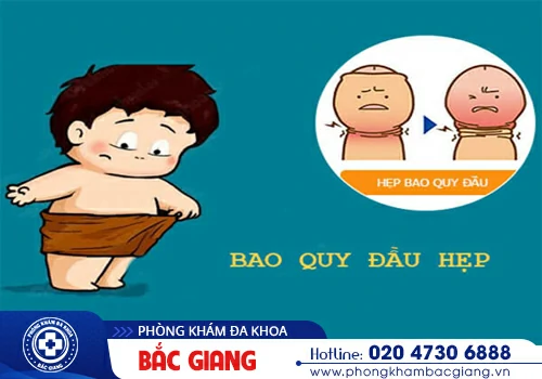 Hẹp bao quy đầu và những vấn đề xoay quanh nam giới cần biết