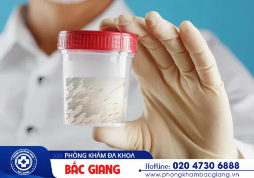 kiểm tra tinh dịch đồ