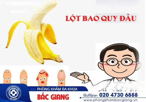 Tại sao cần phải lột bao quy đầu? Lột bao quy đầu như thế nào an toàn?