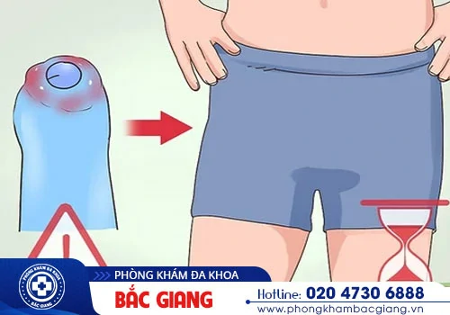 Lột bao quy đầu bị đau nguyên nhân vì sao?