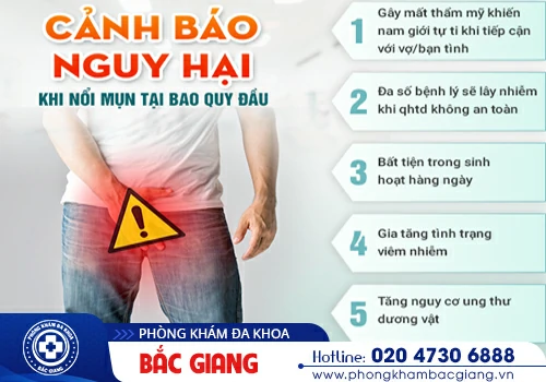 Bao quy đầu nổi mụn - Đừng xem nhẹ