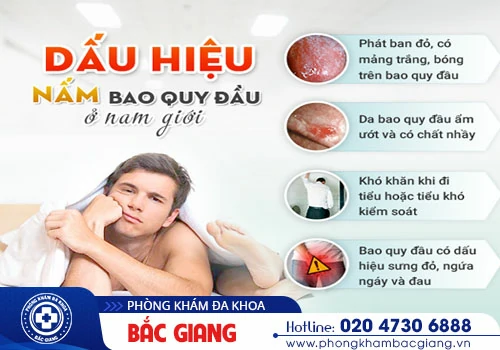 Nấm bao quy đầu: Nguyên nhân, tác hại và cách điều trị