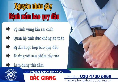 Nấm bao quy đầu: Nguyên nhân, tác hại và cách điều trị