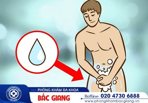 Nấm dương vật có nguy hiểm không? Biểu hiện, Nguyên nhân và Địa chỉ điều trị