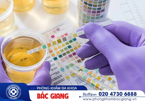 Nam giới nhận thấy nước tiểu có màu lạ là bệnh gì?