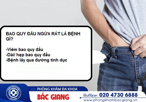 Ngứa bao quy đầu - Triệu chứng tiết lộ các bệnh lý nam khoa nguy hiểm