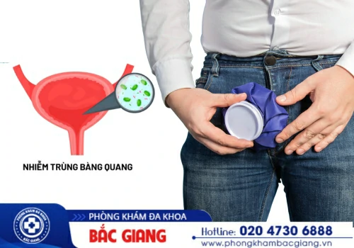 Nhiễm trùng bàng quang ở nam giới và cách điều trị