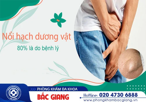 Nổi hạch vùng kín nam - Dấu hiệu cảnh báo bệnh lý nguy hiểm