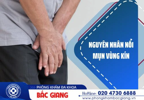 Mụn vùng kín và những nguyên nhân thường gặp