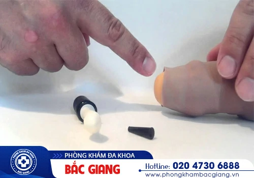 Nong bao quy đầu để làm gì? Các phương pháp thực hiện an toàn