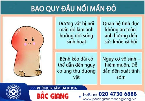 Bao quy đầu nổi mẩn đỏ - Nam giới chớ được chủ quan