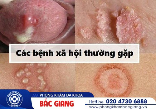 Rách bao quy đầu có biểu hiện gì? Có nguy hiểm không?