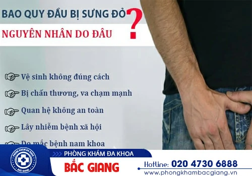 Sưng đỏ quy đầu là bệnh gì? Nguyên nhân và cách khắc phục