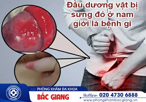 tổng hợp hình ảnh bệnh vùng kín nam 