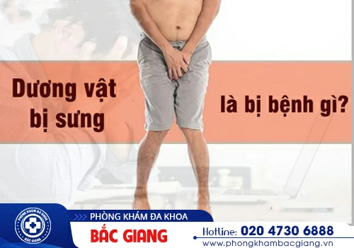 Sưng dương vật - Tình trạng khá nguy hiểm liên quan đến nhiều căn bệnh nam giới