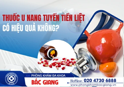 Thuốc u nang tuyến tiền liệt có hiệu quả không?
