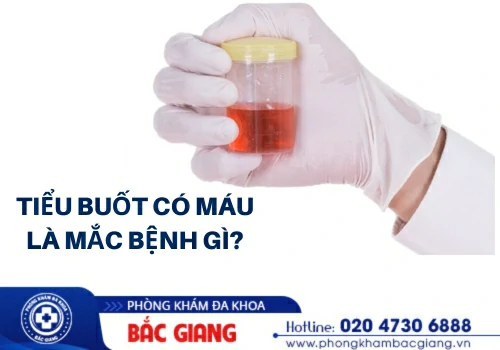 Tiểu buốt có máu là mắc bệnh gì?