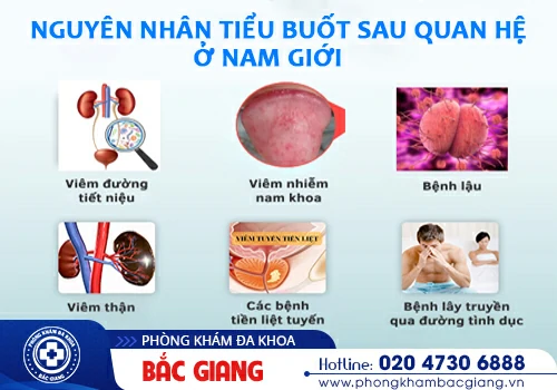 Tiểu buốt sau khi quan hệ - Cảnh báo 5 bệnh lý nguy hiểm