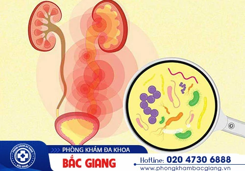 Tiểu rắt ở nam: Nguyên nhân và Cách điều trị