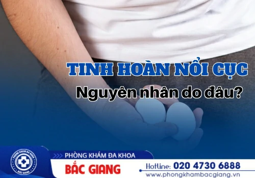 Tinh Hoàn Nổi Cục Có Phải Bệnh Nguy Hiểm? Tìm Hiểu Ngay!