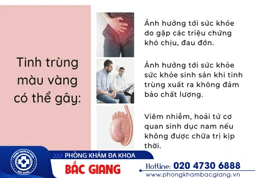 Giải đáp: Tinh trùng có màu vàng là dấu hiệu bệnh gì?