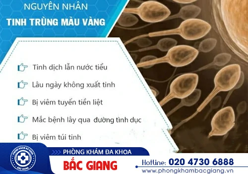 Giải đáp: Tinh trùng có màu vàng là dấu hiệu bệnh gì?